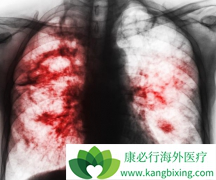 �ΰ�ҩ�￭����/����������������ı�׼��ʲô