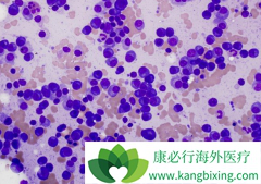 ����/�������׶Ծ��и�Σ���صĶ෢�Թ���������Ҳ������