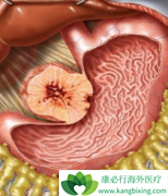 �о���������/���������ܸ���KTI����ȥ��������ϸ��