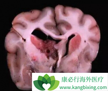 �԰������ڱ��������ʹ�ɳ������������������û�н�һ����ɢ