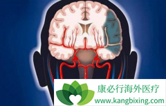 �������͵��԰����ɲ���ͷʹ­�ڸ�ѹ��������֢״