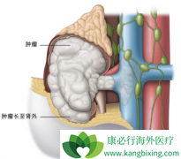 ����������ѡ�����ҩ�����ƻ��Ǽ�����