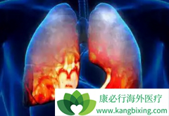 �����ķ���ά����֢״��ʲô�����˷���ά���ܻ��ã�