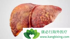 ��ɸΰ����߷�����˥�ߵ���Ҫԭ������Щ