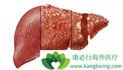 �ΰ������ܻ�������Щ��Ҫ�����й�