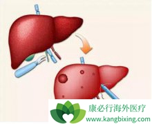 ���Ԥ�����߸���ֲ����֮���Ҹθ���