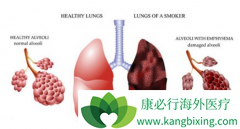 �ΰ����߷��ð�ϣ����(OSIMERTINIB)��Ӱ�컳�кͲ�����