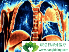 �ΰ�ҩ���ϣ����(AZD9291)���µĲ�����Ӧ������