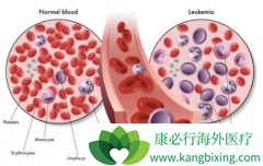 ��������(sorafenib)�������Ԥ����Ѫ���������õ�