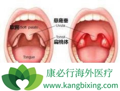 �����尩��֢״����Щ�������ЧԤ����