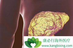 ��������(SORAFENAT)����HCV+�ĸΰ�����������������