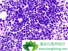 �����׵�/���ǶȰ����ϵͼ�������������������MM��Ч�ʳ�90%