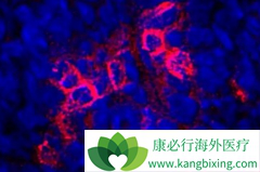 ������/��������������Ч����Kras��13������ͻ���Ӱ��