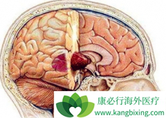 CAR-Tϸ�������Ʒ�����������Խ�����������Ч��