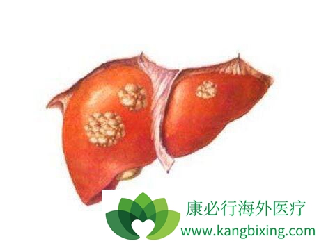 HBV