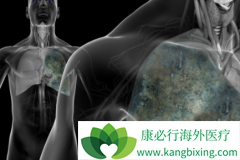 ���޿�(ERLOTINIB)�Ͱ�����������ҩ�����÷ΰ����߻�ĸ�����