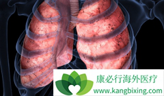 ɫ������(Ceritinib)������ROS1�������ŷΰ����ߵ�������