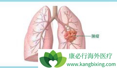 �ΰ�����������ܹ���Ч�ر���ΰ�ת��