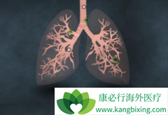 �¸�����������(GRLONAT)������ƿ��ӳ��ֲ���չ�ڻ��ߵ�������