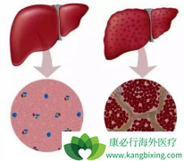 �༪��(SORAFENIB)��ʹ���ߵ�����ȫ����ʧ�������