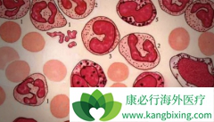 ������(Imatinib)�����ڼ仼����Ҫ�����Щ��Ŀ������ʲôʱ����