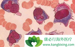 ������/��������Ϊ����������������������໺���ʺ�͸����ֹ��