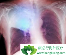 PD-1ҩ�����䵥��(Opdivo)��ʹ���ַΰ����߻�ó�������