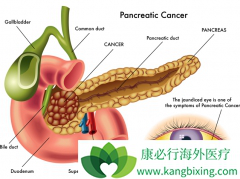 �����������ٰ���ҩ���޽�չ����û���������ٰ��İ���ҩ��������ҩ��