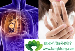 ���߷��ð�������(GILOTRIF)�ڼ�Ҫ��ʱע��Ƥ���仯