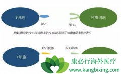 �ΰ����ߺ�ʱӦ�ý���PD-1���ƣ���Щ���߲��ʺϽ���PD-1���ƣ�