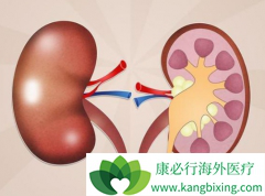 ��������/Ӣ��������ķ��������ʱ��������ܼ���Ϊ5mg