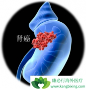 ��������(Sunitinib)���������������Ƶ���Чҩ����