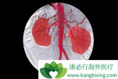 ��������(Cabozantinib)���п���ʵ������ת�Ƶ�����