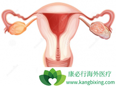 ���ٰ�����BRCA�������ѳ���Ҳ�й���