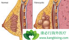 ��������(palbociclib)���������ٰ�ҩ����Эͬ����