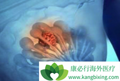 ��������(Palboclib)�����ڷ��ڵֿ��������о޴�Ļ���