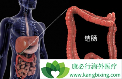 ��Ī«����/��Ī¬�����������ƽ�ֱ����Ч������