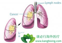 ��Сϸ���ΰ����Ӱ�������ʧ�ܺ���ʲô���Ʒ����ɹ�ѡ��