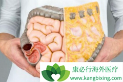 ǰ������Ӱ��������/���������ת���Խ�ֱ�������ߵ�������