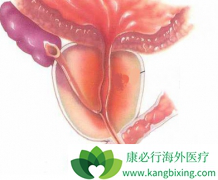 ǰ���ٰ����߷��ð�������(ABIRATERONE)�г��ֵ�Ѫ�صķ���