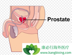 �ι����𺦺͸ζ�������µİ�������(XBIRA)��������ԭ��