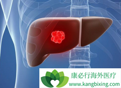 ����ҩ���ַ�����(lenvatinib)���Ƹΰ�Ч������