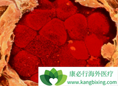 �������޿�(GRLONAT)��Ϊʲô���ж������µĸо�