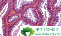 ��������/������ҩ�������ΰ���ת�ƻ�����Ч���Ƕ���