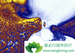 Ϊʲô̩��ɯ(AZD9291)������PD-1ҩ������ʹ��