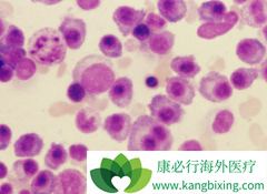 ���ǶȰ�(lenalidomide)������������û�ϸ����Ⱦ��