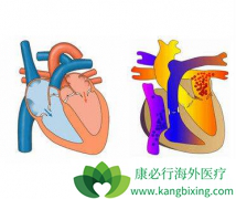 ����̹(Bosentan)���µ���Һ������ʲô֢״����