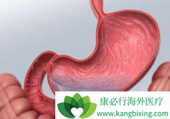 ��������(Olaparib)������ɼ������Ϊθ�����ߵ�һ���Ʒ���