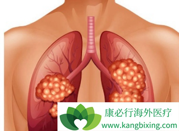 吉非替尼 吉非替尼