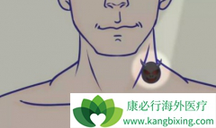 ���䵥��/ŷ������������ת�Ƶĺ�ɫ����������